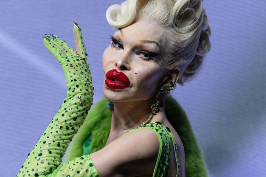 You are currently viewing Amanda Lepore explains how being bullied as a kid inspired her: “I didn’t want to look like a basic girl”